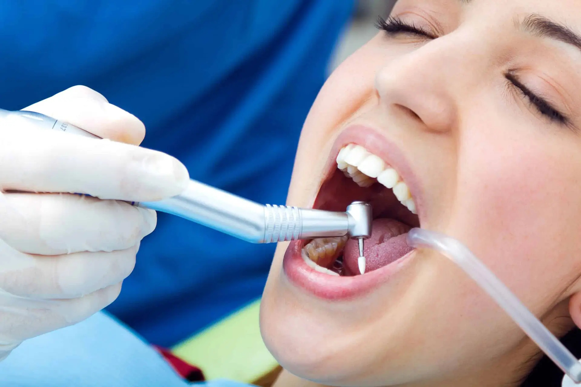 Fillings at the practice